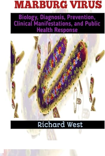 Marburg Virus: Biology, Diagnosis Prevention, Clinical Manifestations And Public Health Response